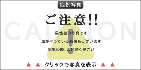 長茎術・増大術の症例写真を専門医が年齢別（20代〜…